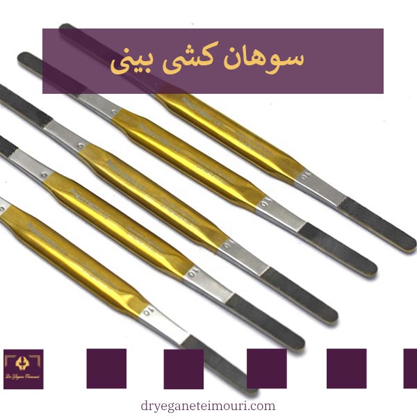 سوهان کشی بینی بعد از عمل _ دکتر یگانه تیموری