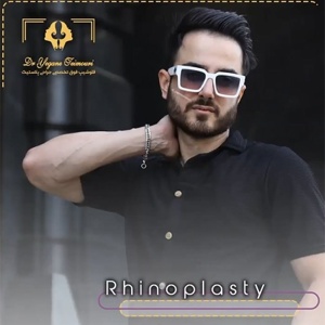 rhinoplasty6