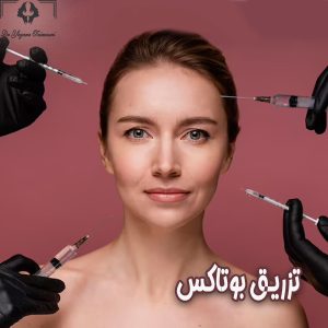 تزریق بوتاکس- دکتر یگانه تیموری