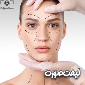 لیفت صورت-دکتر یگانه تیموری