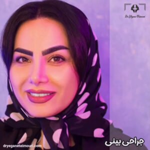 جراحی بینی - دکتر یگانه تیموری