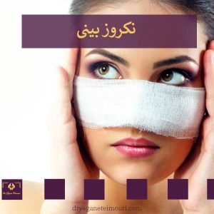 نکروز بینی بعد از عمل _ دکتر یگانه تیموری