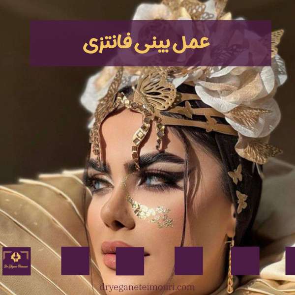 جراحی بینی فانتزی