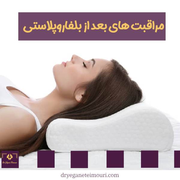 مراقبت های بعد از بلفاروپلاستی