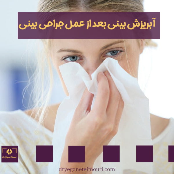 آبریزش بینی بعد از عمل