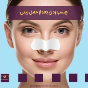 چسب زدن بینی بعد از عمل _ دکتر یگانه تیموری