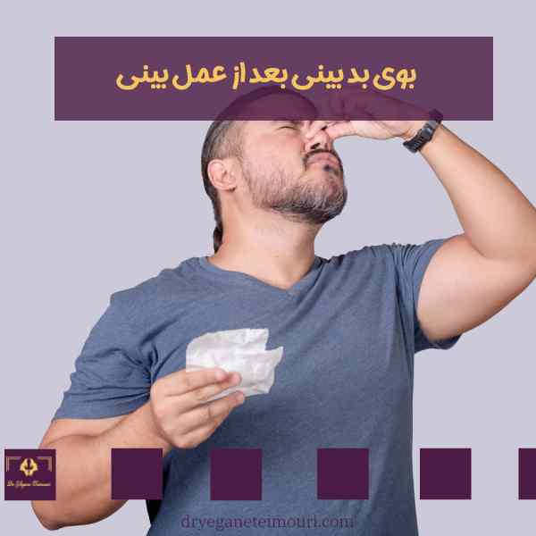 بوی بد بینی بعد از جراحی بینی _ دکتر یگانه تیموری