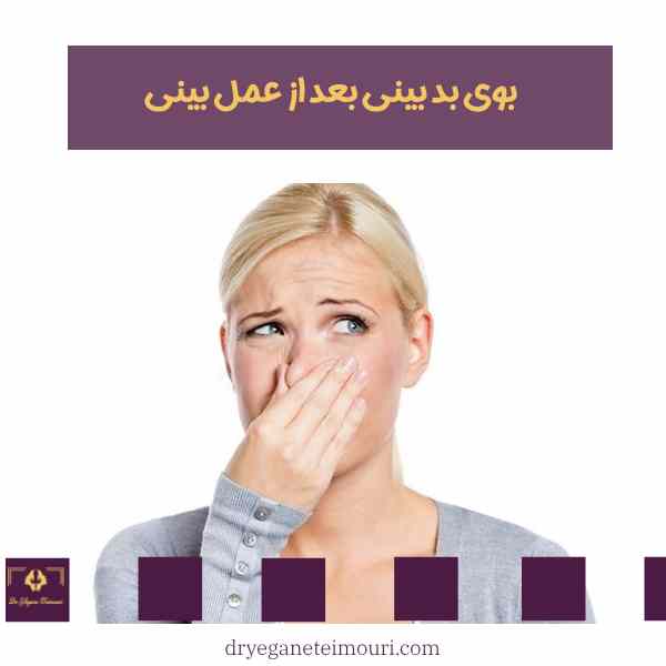 بوی بد بینی بعد از عمل بینی