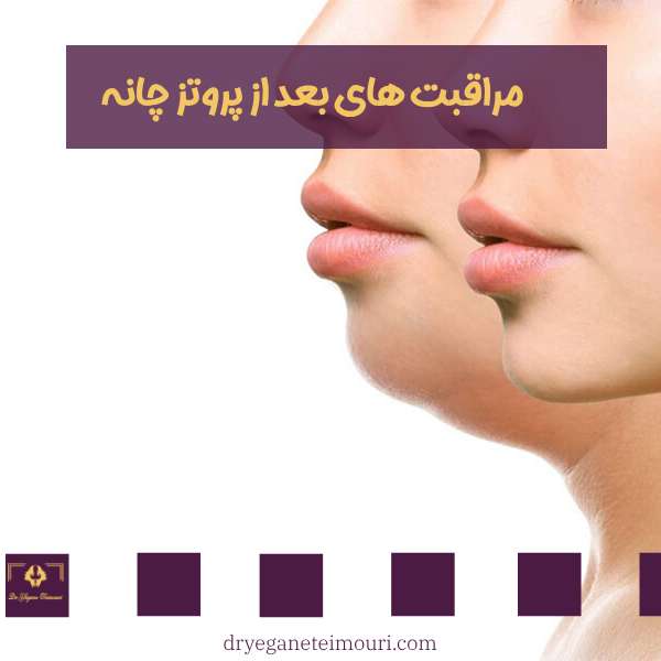 مراقبت های بعد از جراحی پروتز چانه