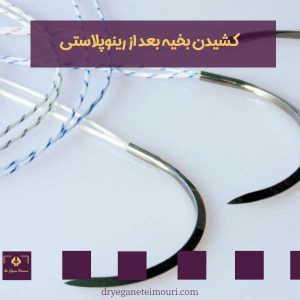 بخیه نوک بینی _ دکتر یگانه تیموری