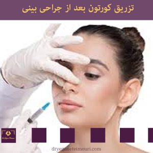 تزریق کورتون بعد از جراحی بینی