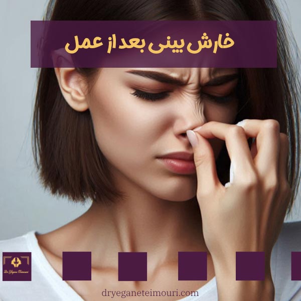 خارش بینی بعد از عمل