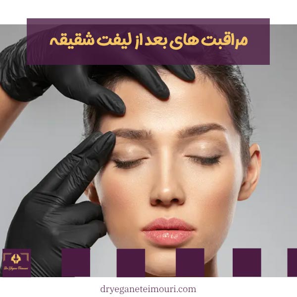 مراقبت های بعد از لیفت شقیقه