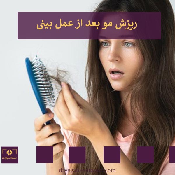 ریزش مو بعد از عمل بینی _ دکتر یگانه تیموری