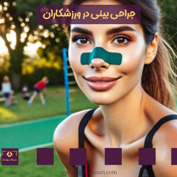 جراحی بینی در ورزشکاران