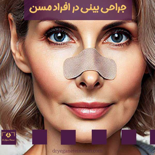 جراحی بینی در افراد مسن