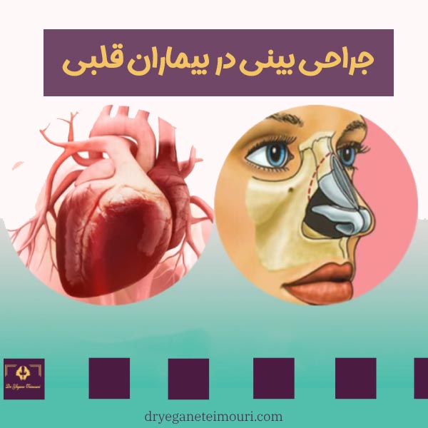 جراحی بینی در بیماران قلبی