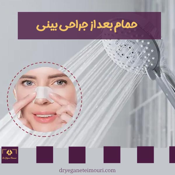 حمام بعد از جراحی بینی