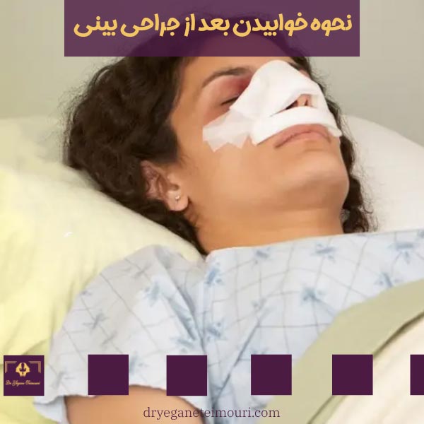 نحوه خوابیدن بعد از جراحی بینی