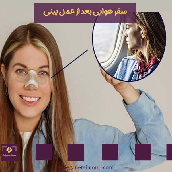 سفر هوایی بعد از عمل بینی