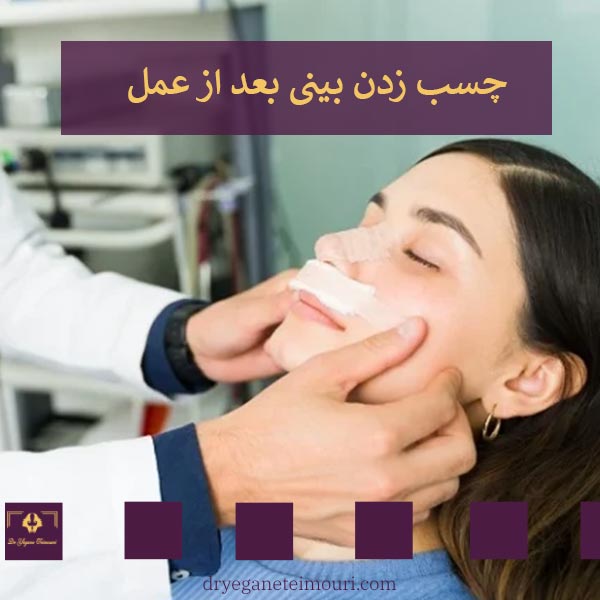 چسب زدن بینی بعد از عمل _ دکتر یگانه تیموری