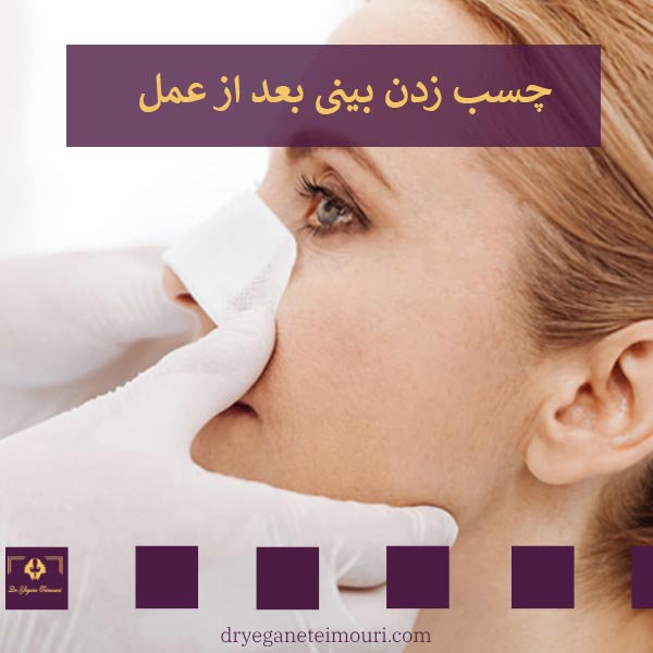 چسب زدن بینی بعد از عمل _ دکتر یگانه تیموری