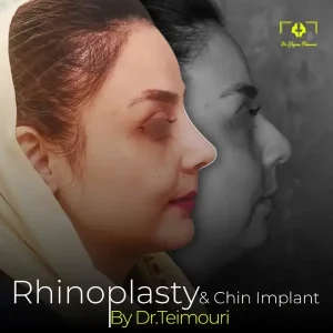 عمل بینی _ دکتر یگانه تیموری