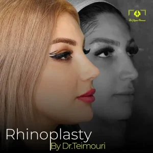 جراحی بینی _ دکتر یگانه تیموری