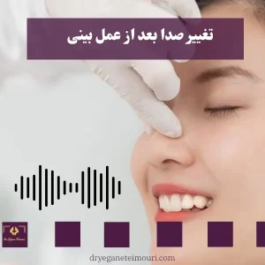 تغییر صدا بعد از عمل بینی _ دکتر یگانه تیموری
