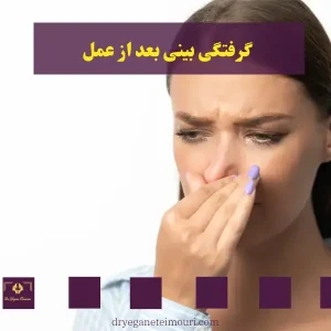 کیپ شدن بینی بعد از جراحی _ دکتر یگانه تیموری