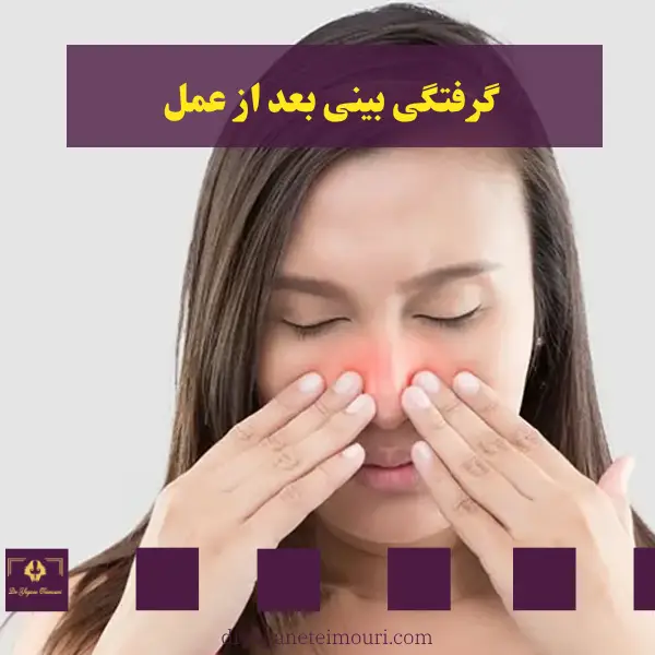 گرفتگی بینی بعد از عمل - دکتر یگانه تیموری
