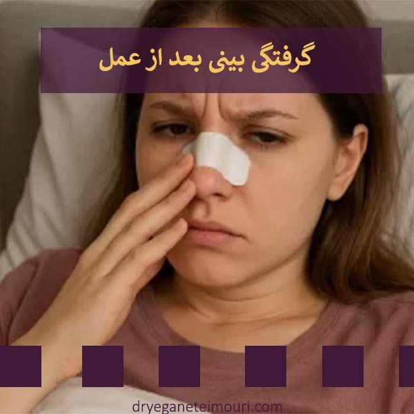 گرفتگی بینی بعد از عمل _ دکتر یگانه تیموری