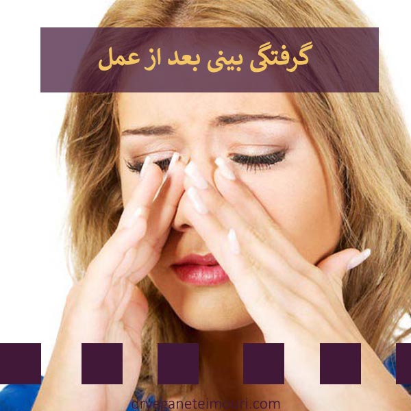 گرفتگی بینی بعد از عمل _ دکتر یگانه تیموری