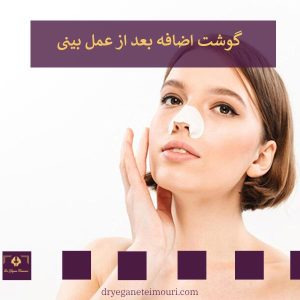 گوشت اضافه بعد از جراحی بینی _ دکتر یگانه تیموری