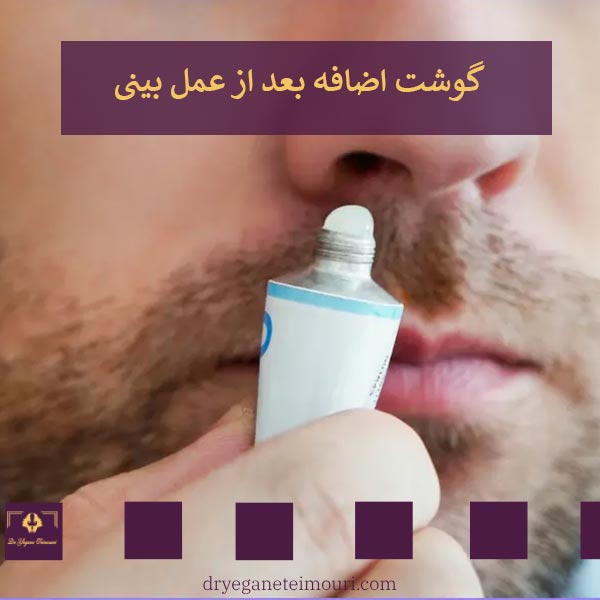 گوشت اضافه بعد از عمل بینی _ دکتر یگانه تیموری
