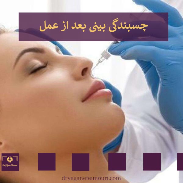 چسبندگی بینی بعد از جراحی _ دکتر یگانه تیموری