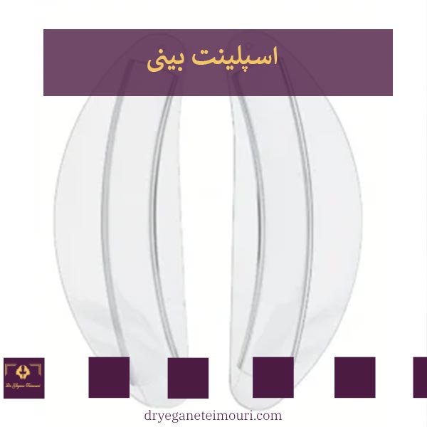 اسپلینت بینی _ دکتر عطاالله حیدری