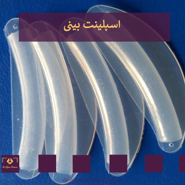 اسپلینت بینی _ دکتر عطاالله حیدری