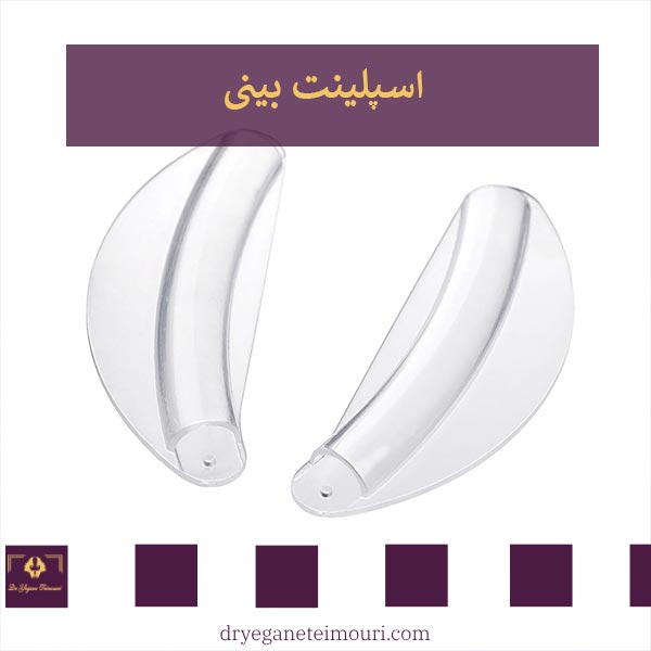 اسپلینت بینی _ دکتر عطاالله حیدری